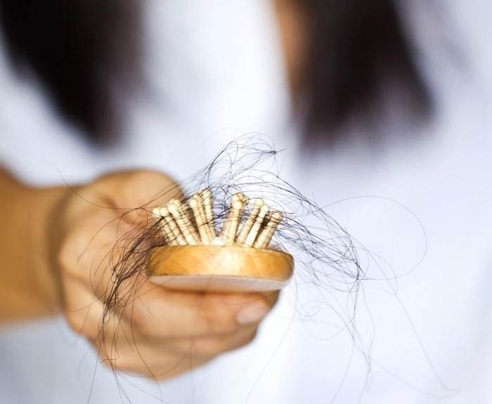 Foto articolo perdita di capelli donne